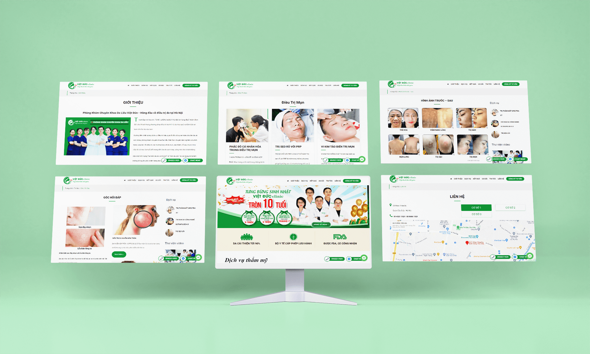 Da liễu Việt Đức